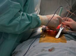 Cardiac Surgery