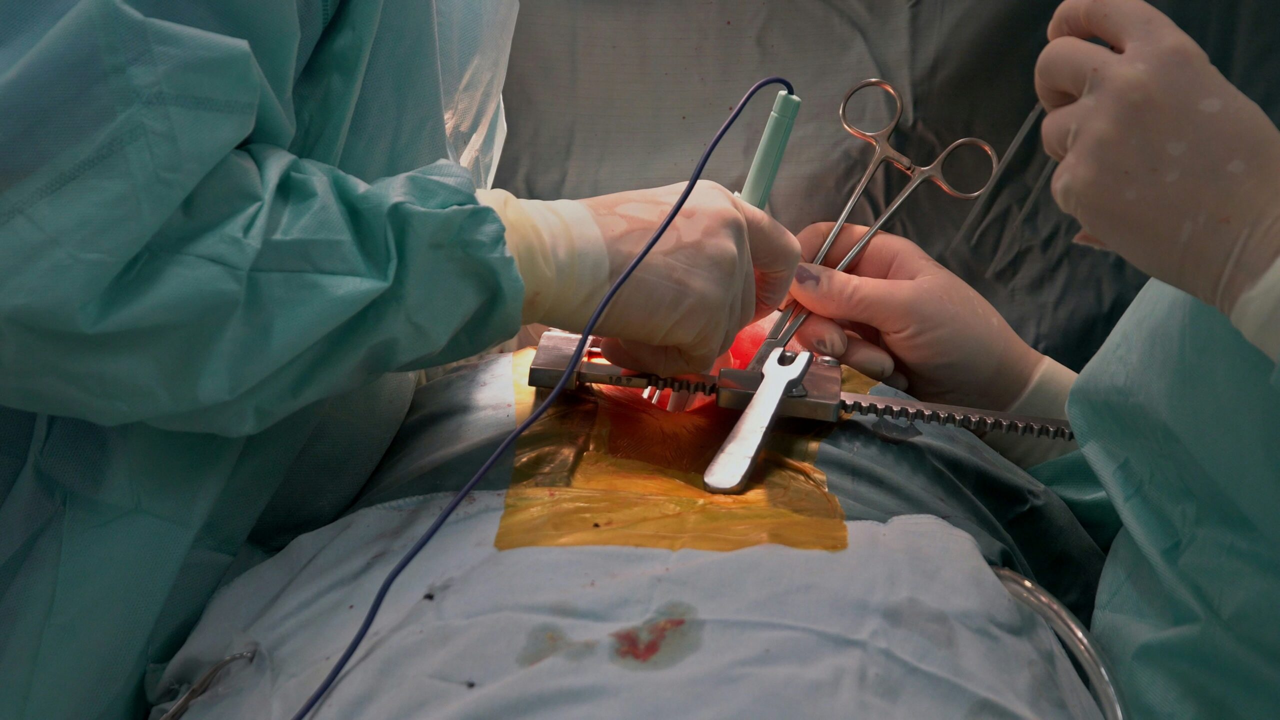 Cardiac Surgery