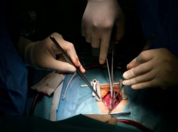 Complex Thoracic Aortic Disease