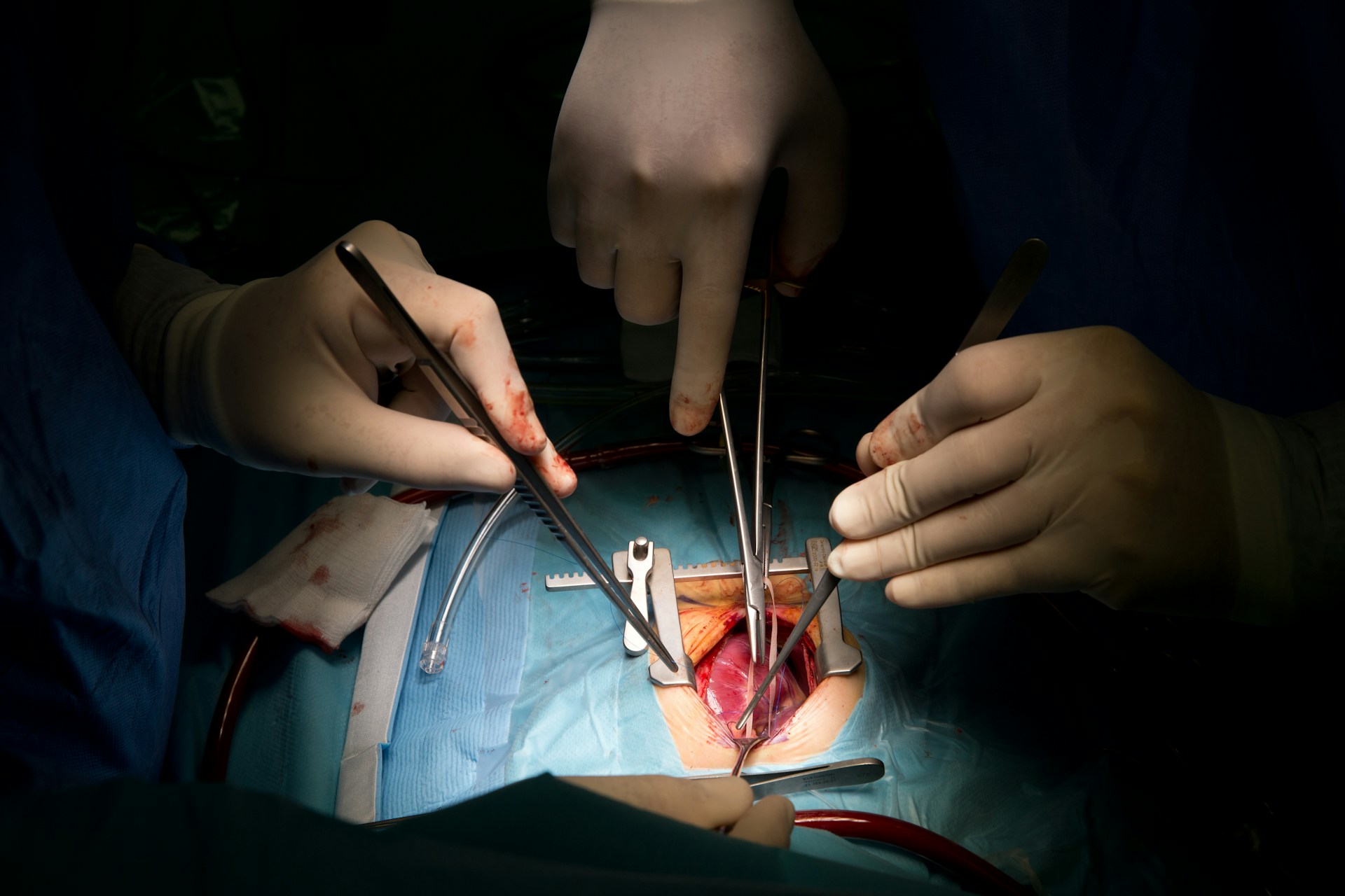 Complex Thoracic Aortic Disease