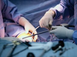 Dr. Vincenzo Giordano:Complex Aortic Surgery