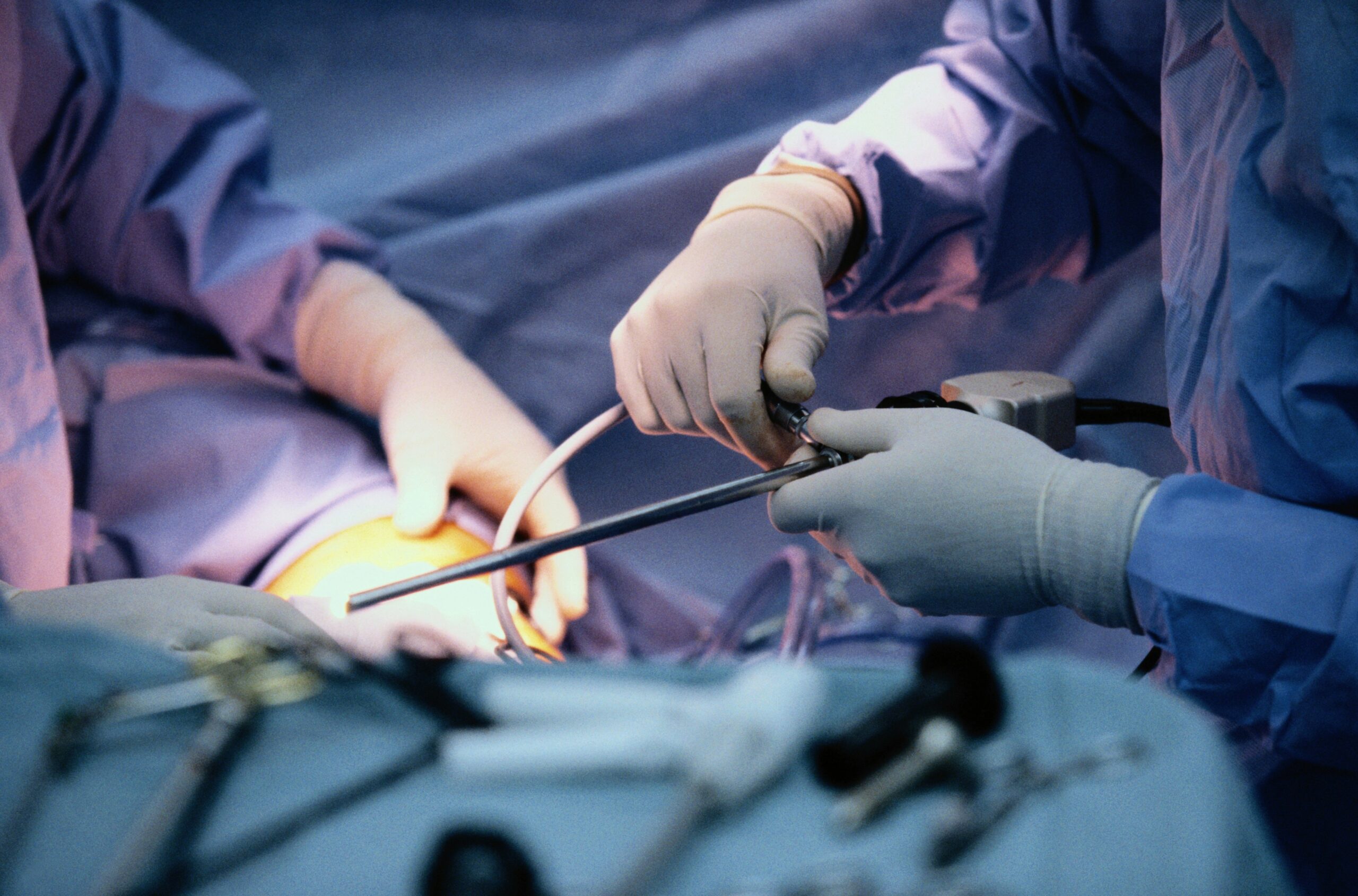 Dr. Vincenzo Giordano:Complex Aortic Surgery